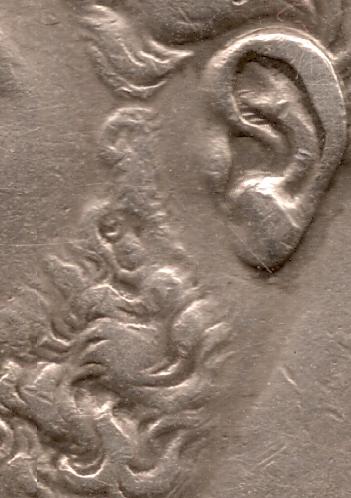 Ridurile sunt in zona urechii deasupra lobului mic. Liniile sunt orizontale.